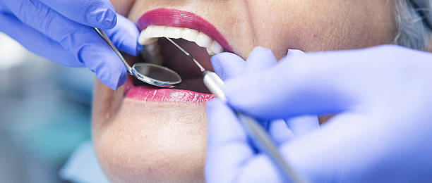Best Emergency Dental Care for Abscessed Tooth in College Place, WA